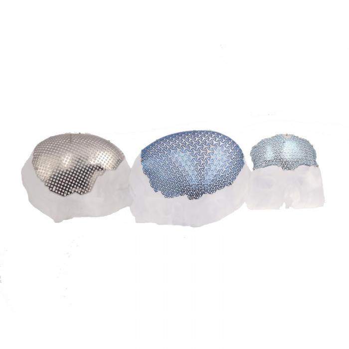 Cranial Titanium mesh